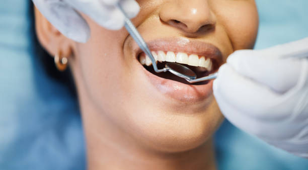 Best Pediatric Emergency Dentist in Carrier Mls, IL